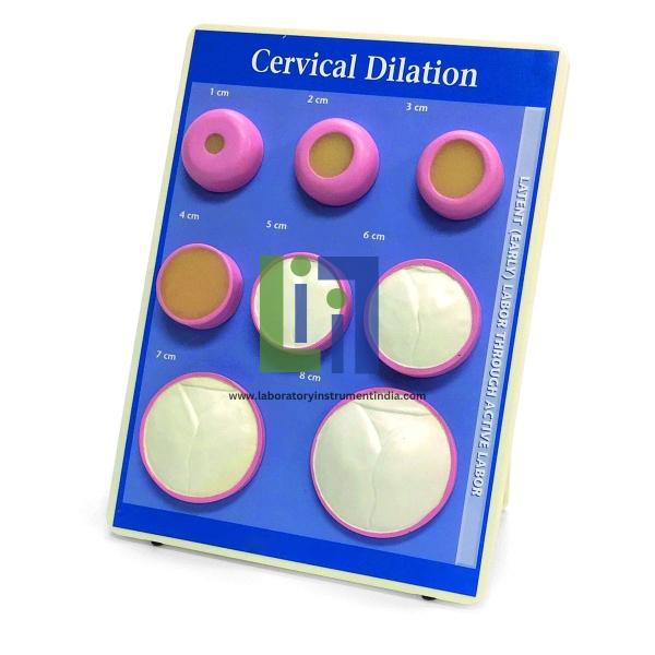 Cervical dilatation model